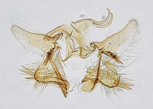 Male genitalia