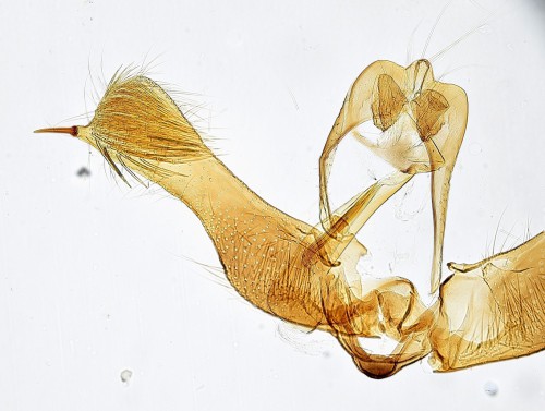 Male genitalia