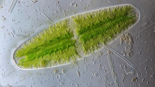 Netrium cf. digitus, kontrast Nomarskiego, ob. 63x z immersją olejową